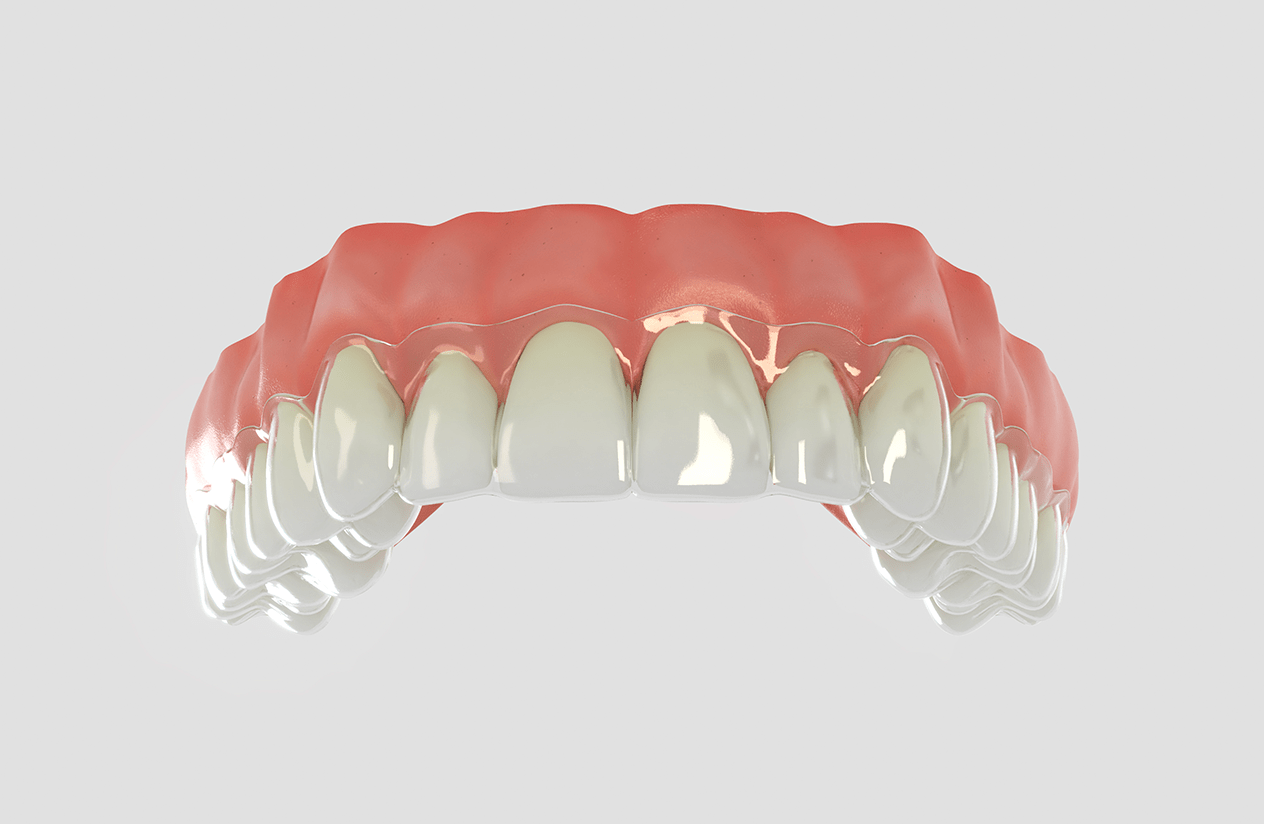 Arcad treatments break down myths about orthodontics.